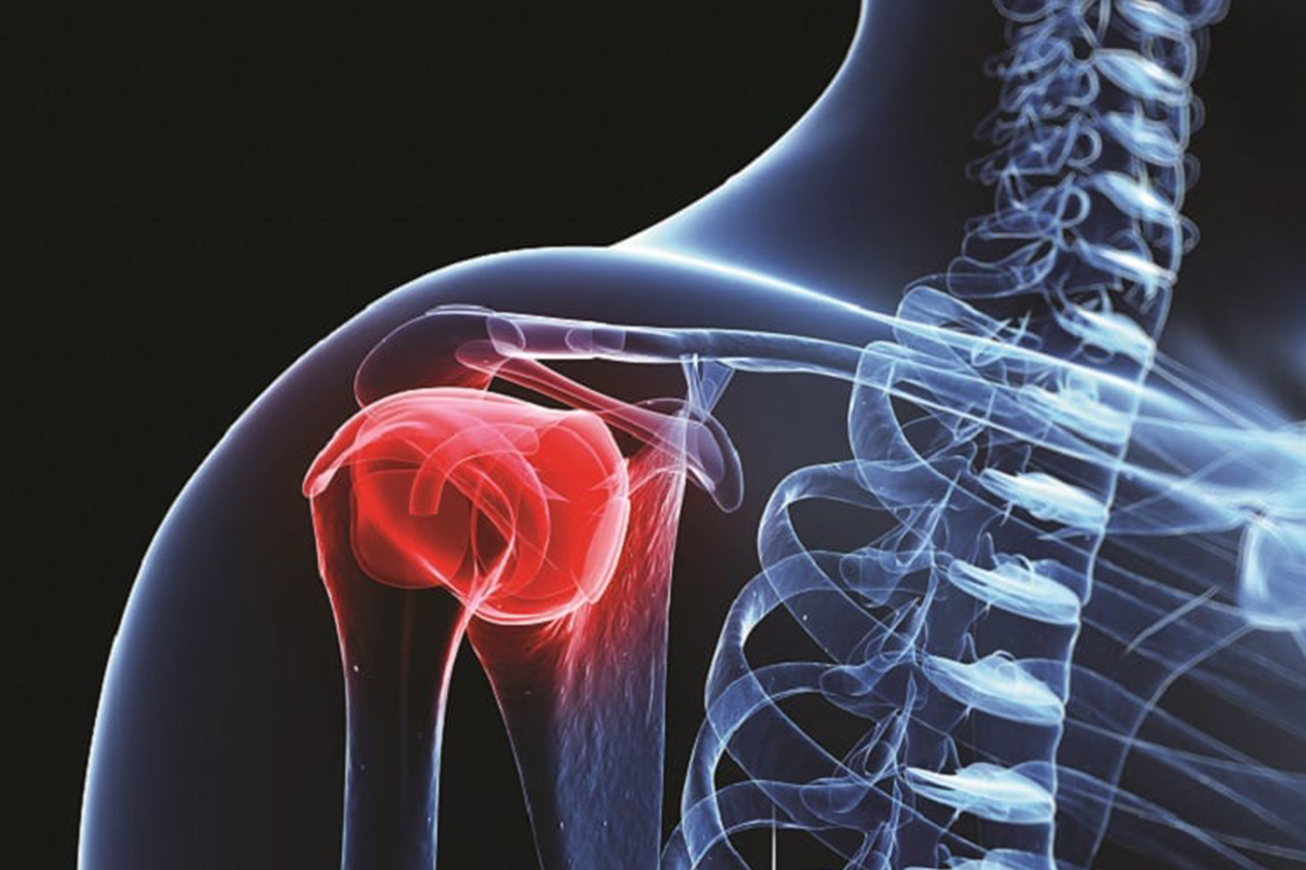 Bone cancer prevention