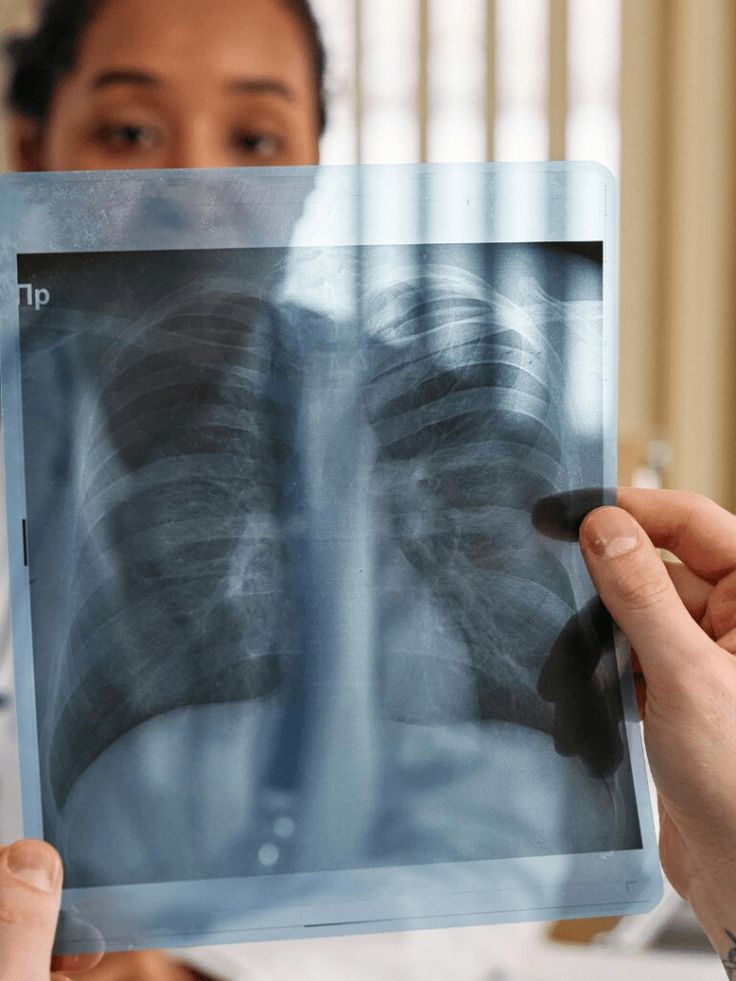 Advanced Cancer treatment